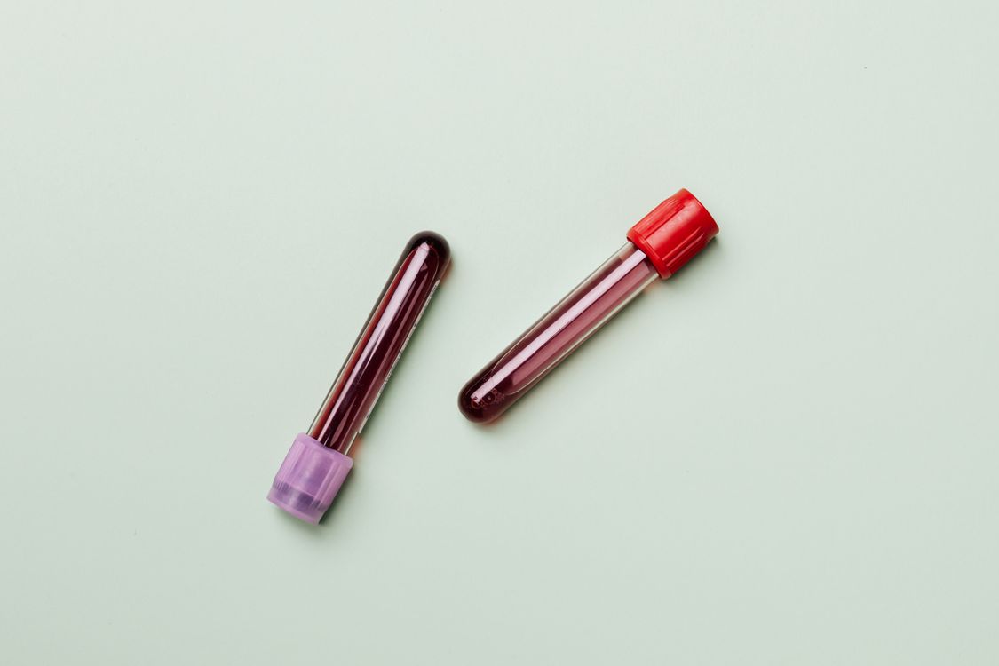 Blood sample tubes lined up for testing on a light surface