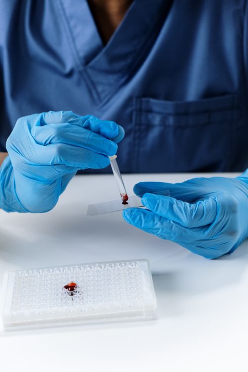 Researcher placing a blood sample on a microscope slide in a laboratory